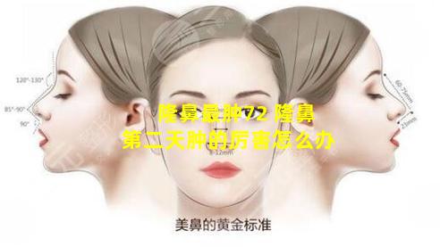 隆鼻最肿72 隆鼻第二天肿的厉害怎么办